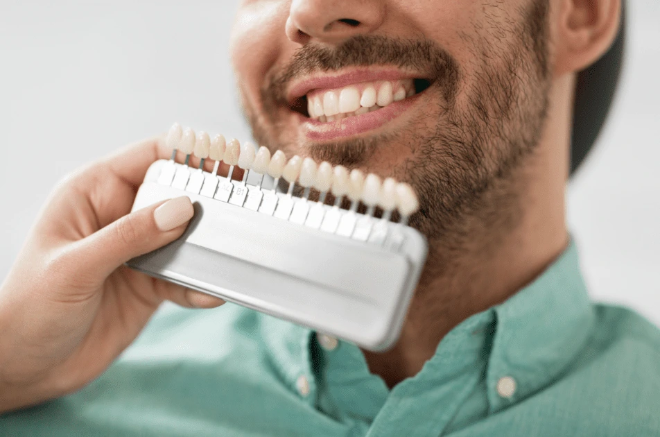 Veneers Different Types Of Sedation Dentistry Dr. Von J. Holbrook. Paso Robles Dental Care. General, Cosmetic, Restorative, Preventative, Pediatric, Family Dentistry Paso Robles, CA 93446 Veneers Different Types Of Sedation Dentistry Dr. Von J. Holbrook. Paso Robles Dental Care. General, Cosmetic, Restorative, Preventative, Pediatric, Family Dentistry Paso Robles, CA 93446