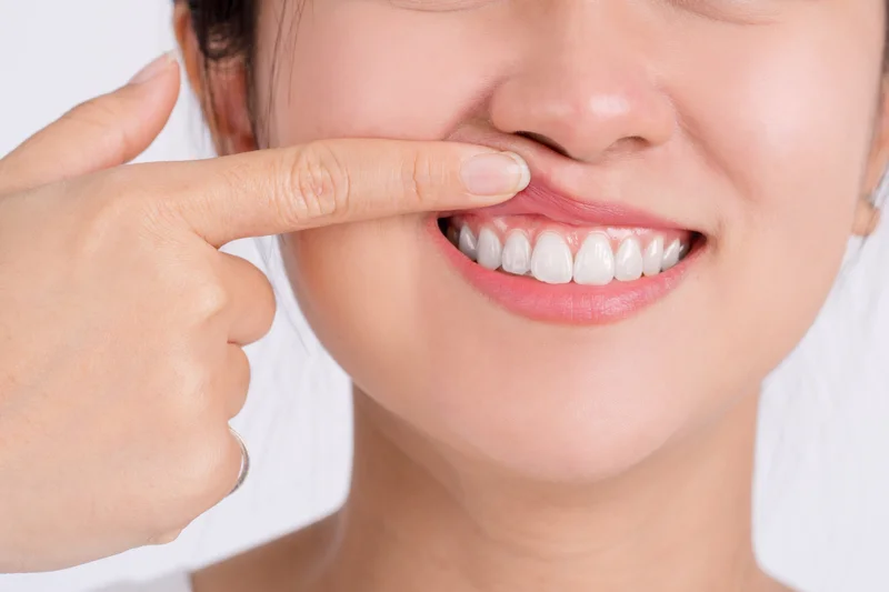 Gum disease treatment Paso Robles