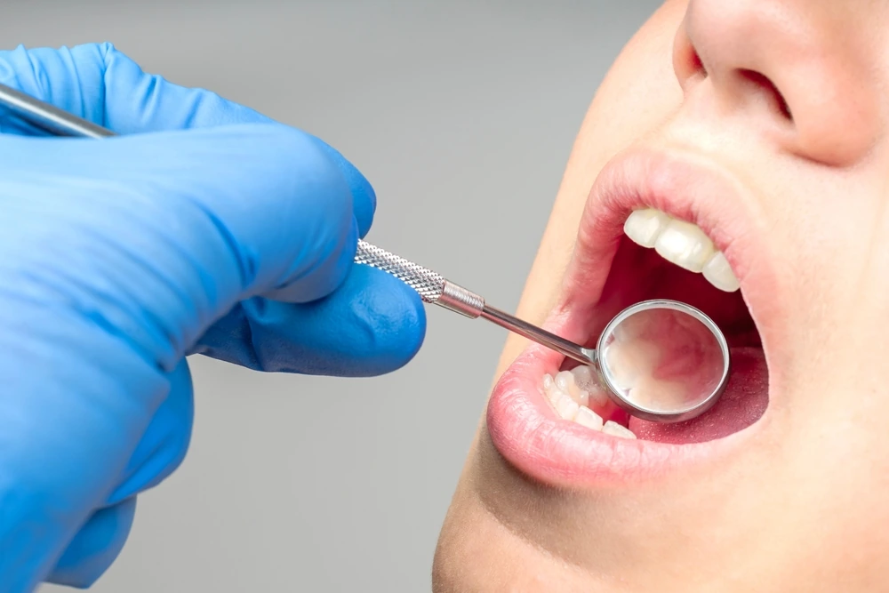 A dental mirror used during an examination
