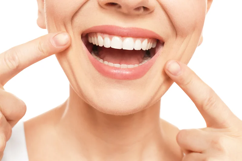 A smiling woman pointing toward her teeth